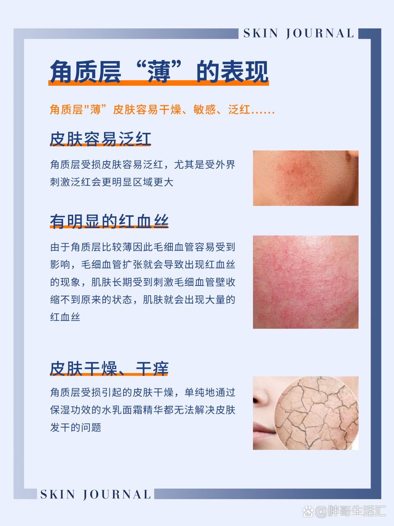 角质层"薄"的表现!