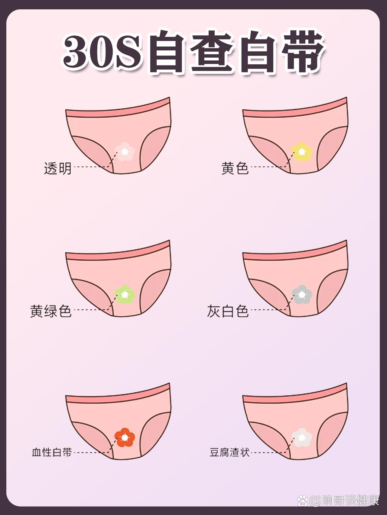 黄绿色 怀孕图片