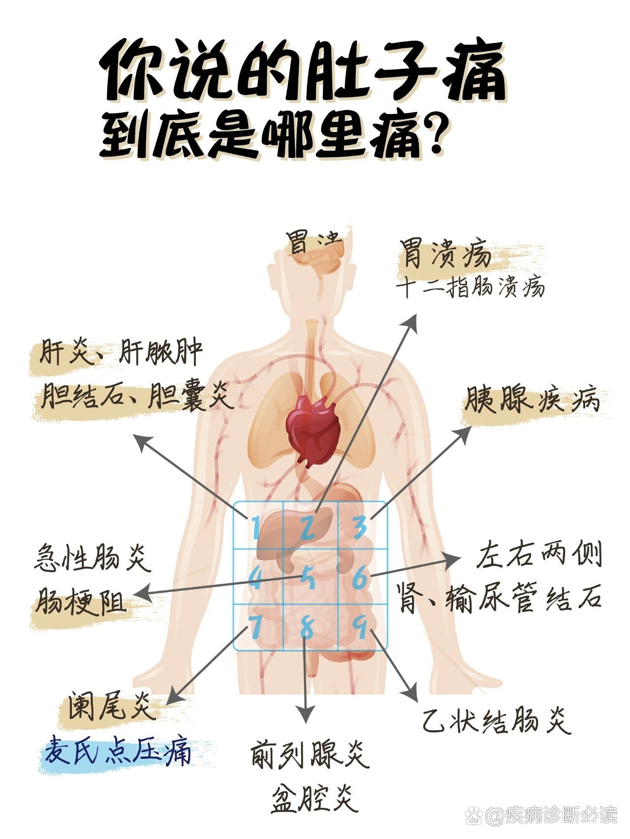 区分对照93 br 根据疼痛区域的不同判断bing灶 br