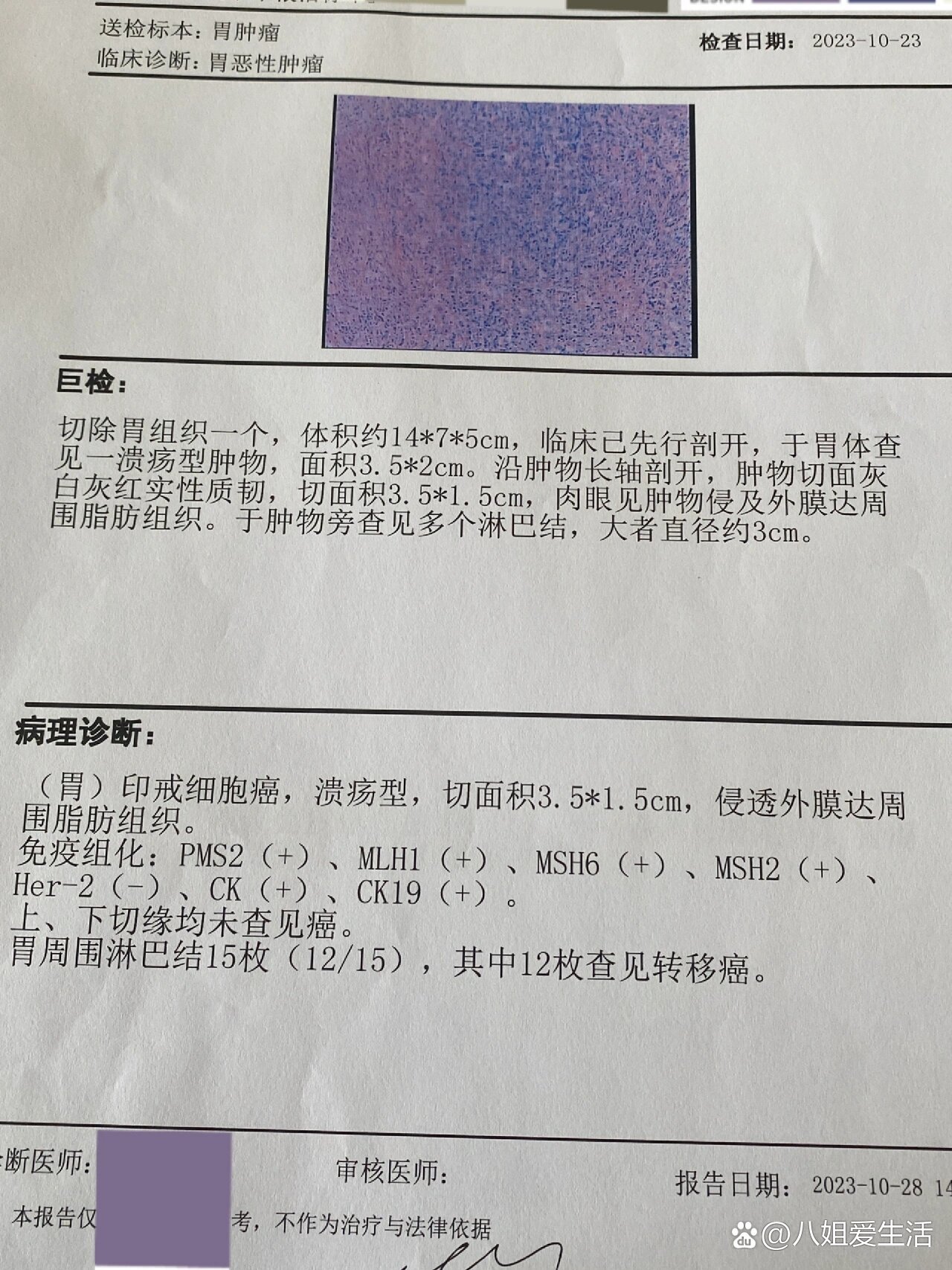 胃癌手术大病理报告