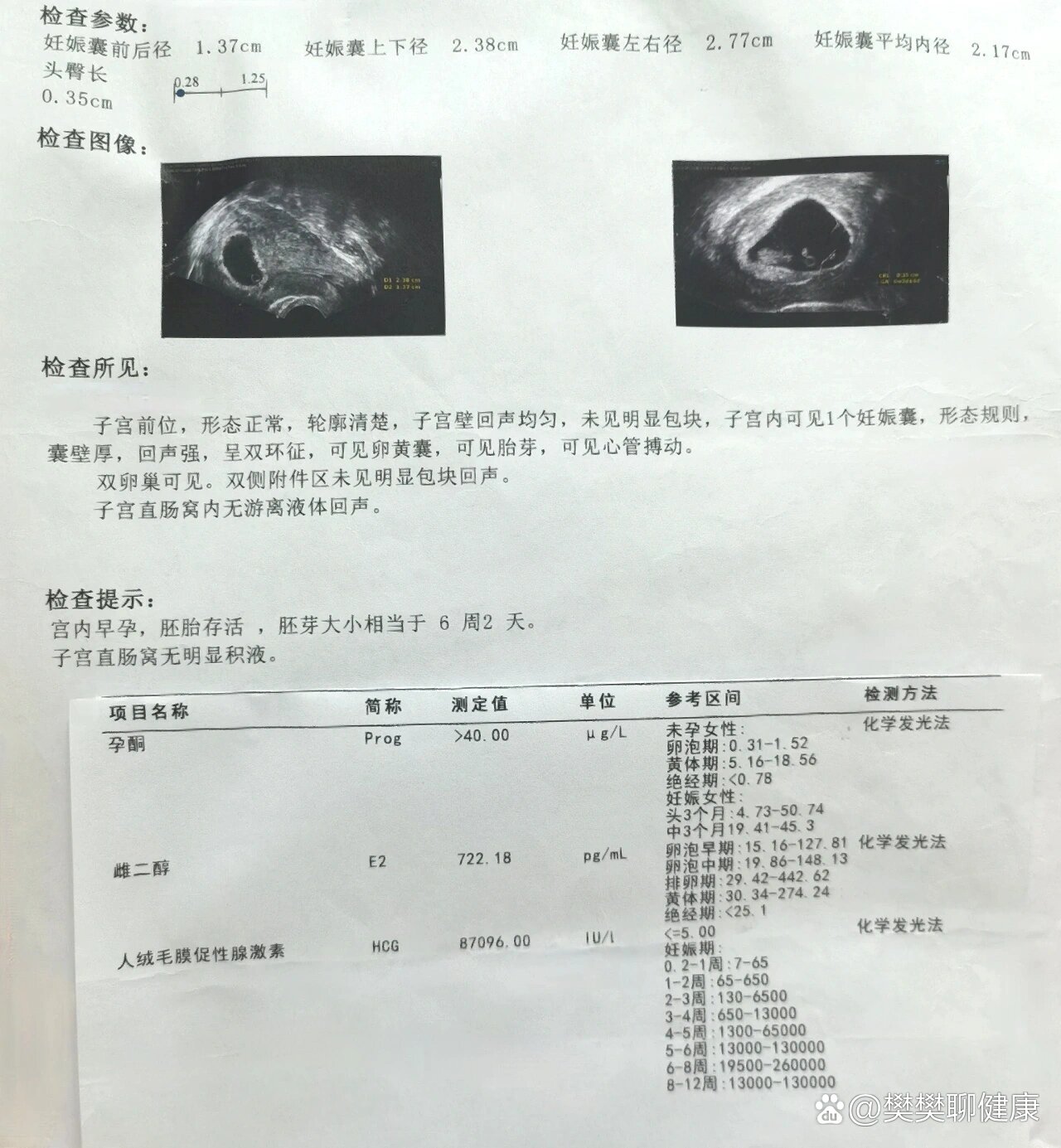 早期先兆流产,两周后终于保胎成功