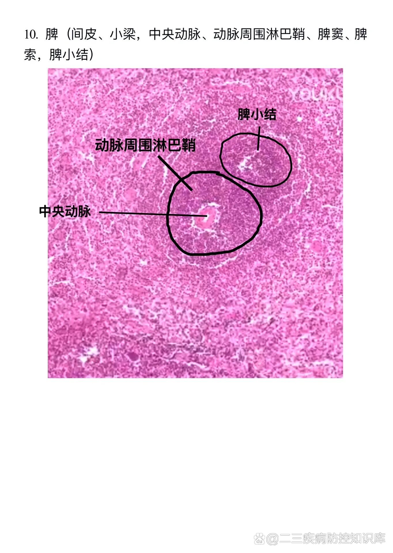 脾切片图结构图片