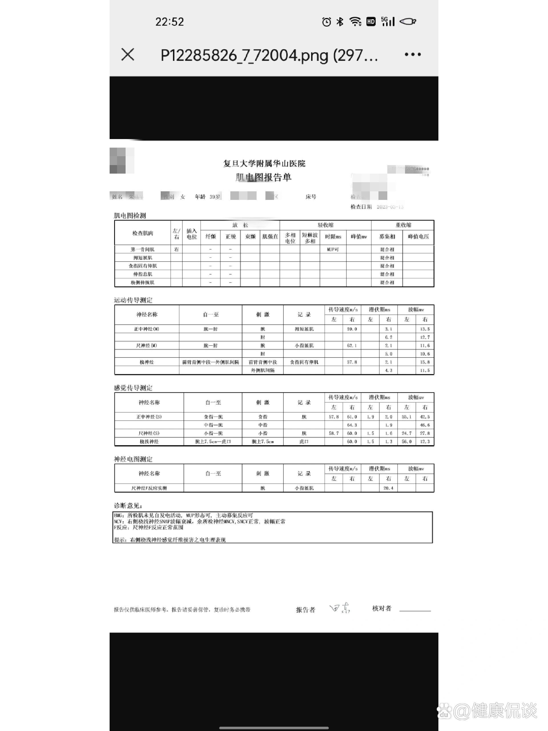 肌电图报告