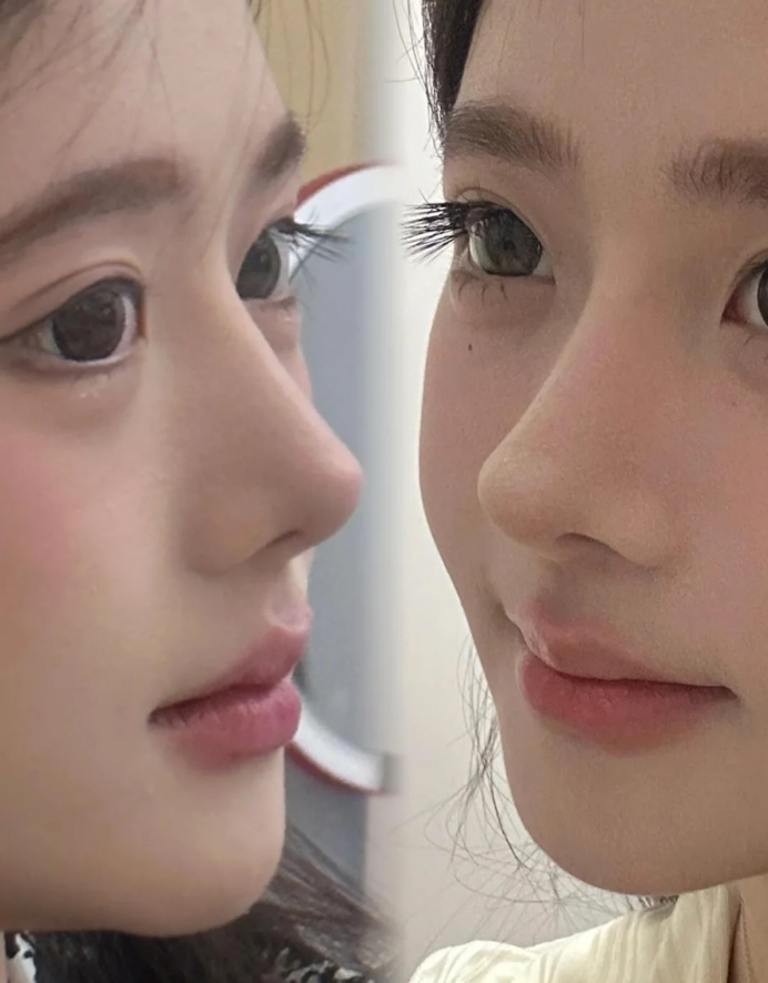 上海幼态妈生鼻天花板!怎么可以这么美!