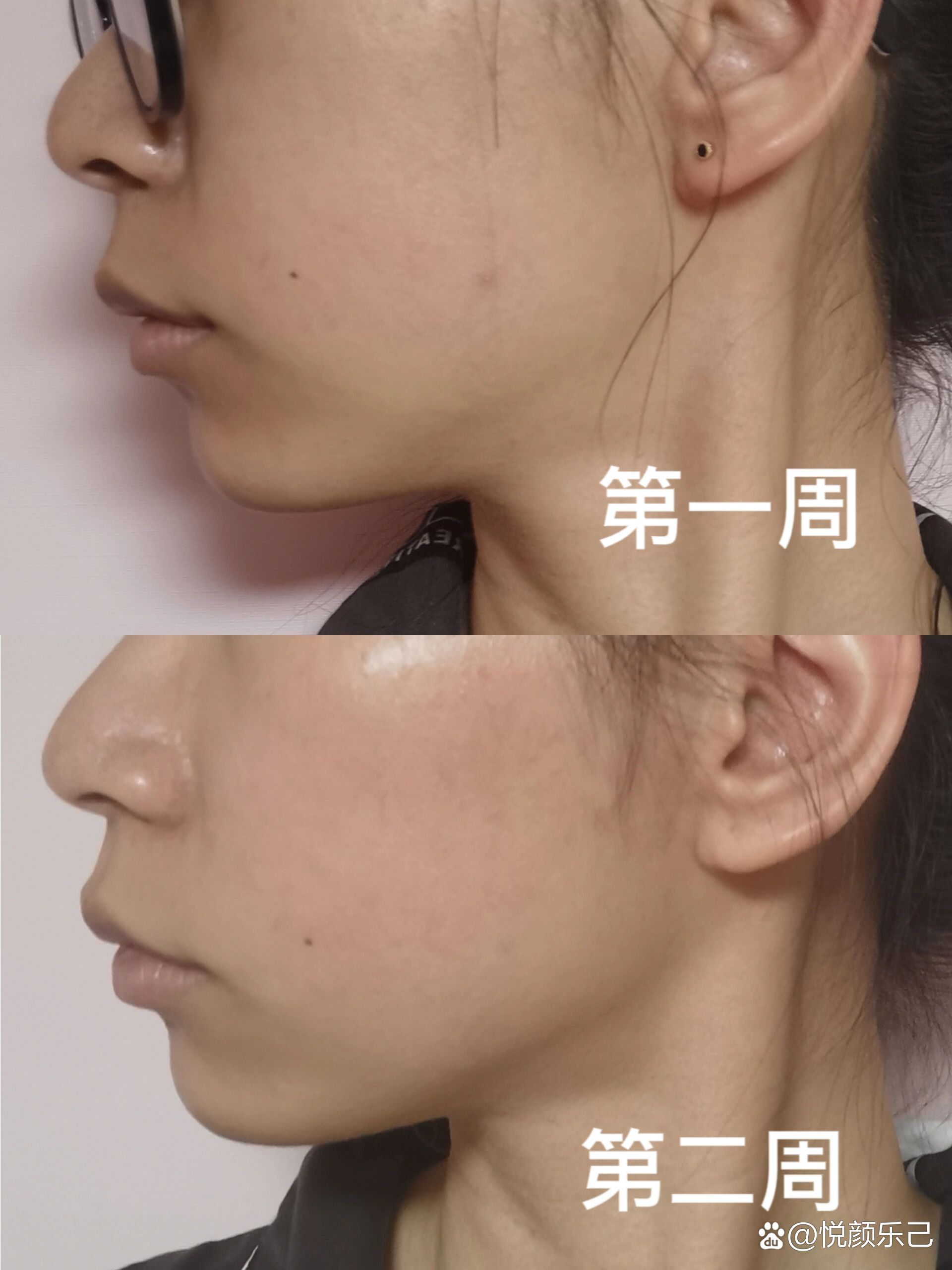 脸歪自我矫正打卡第二周