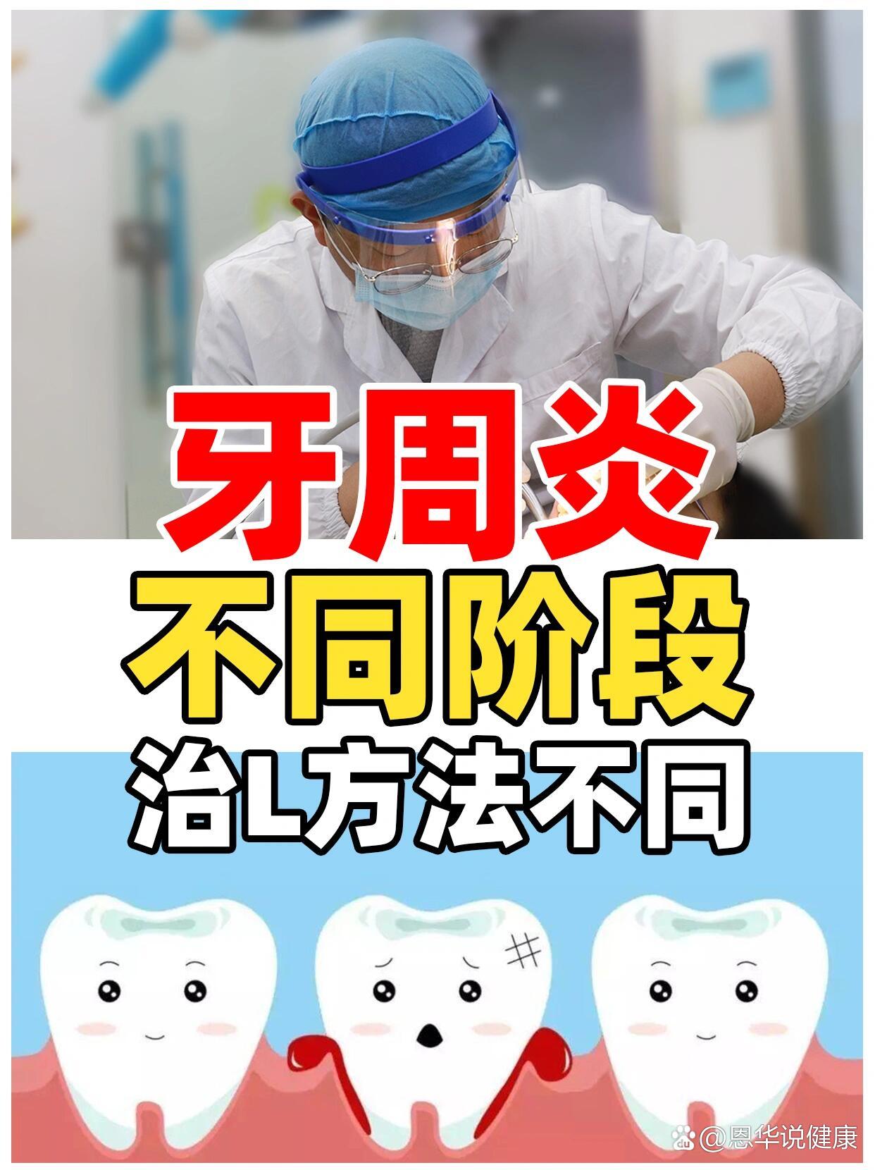 1分种了解牙周炎阶段及治疗方法!