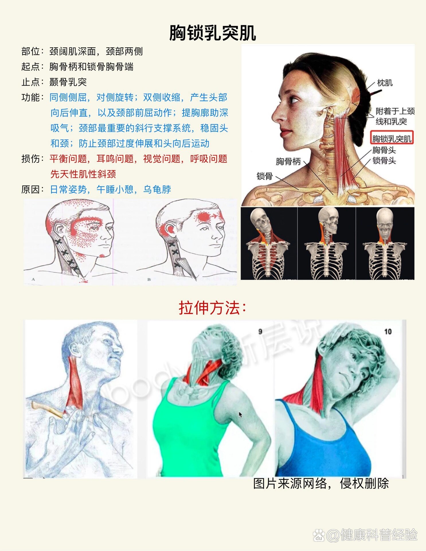 胸锁乳突肌示意图图片