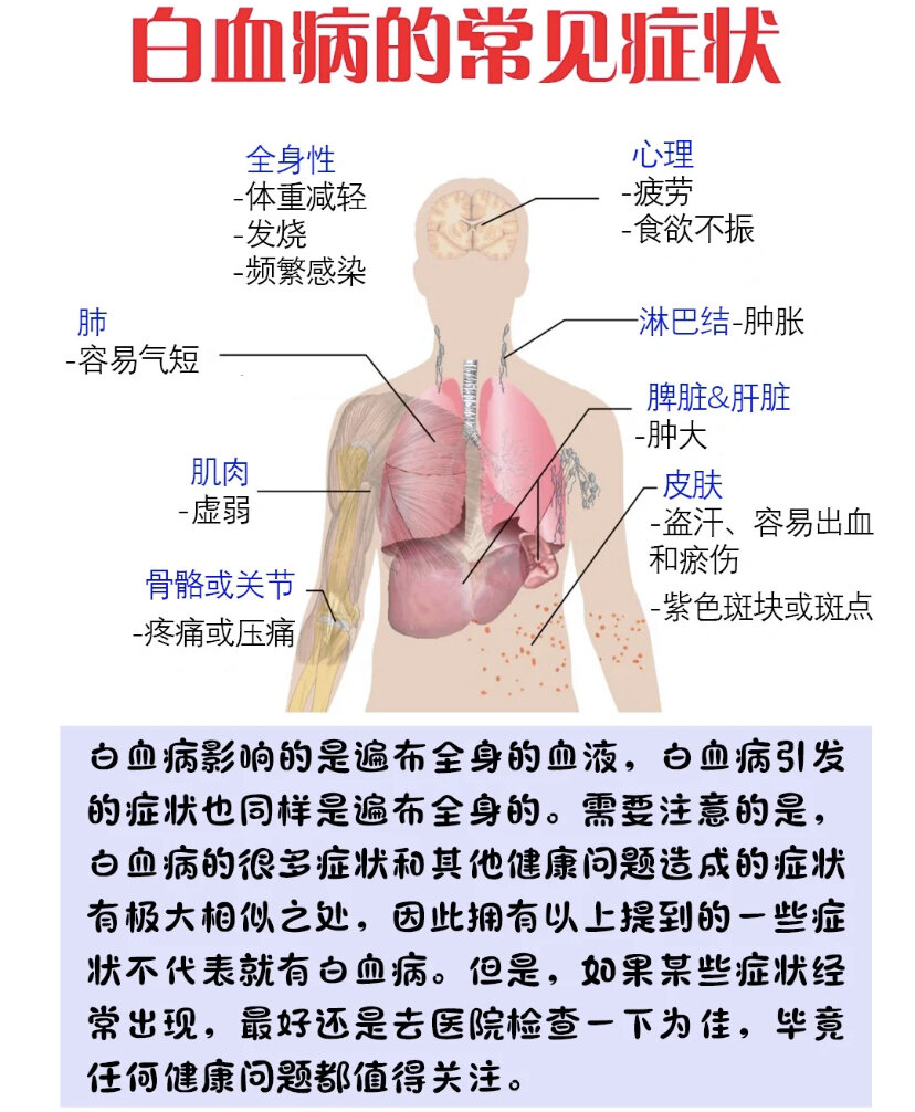 白血病儿童 征兆图片