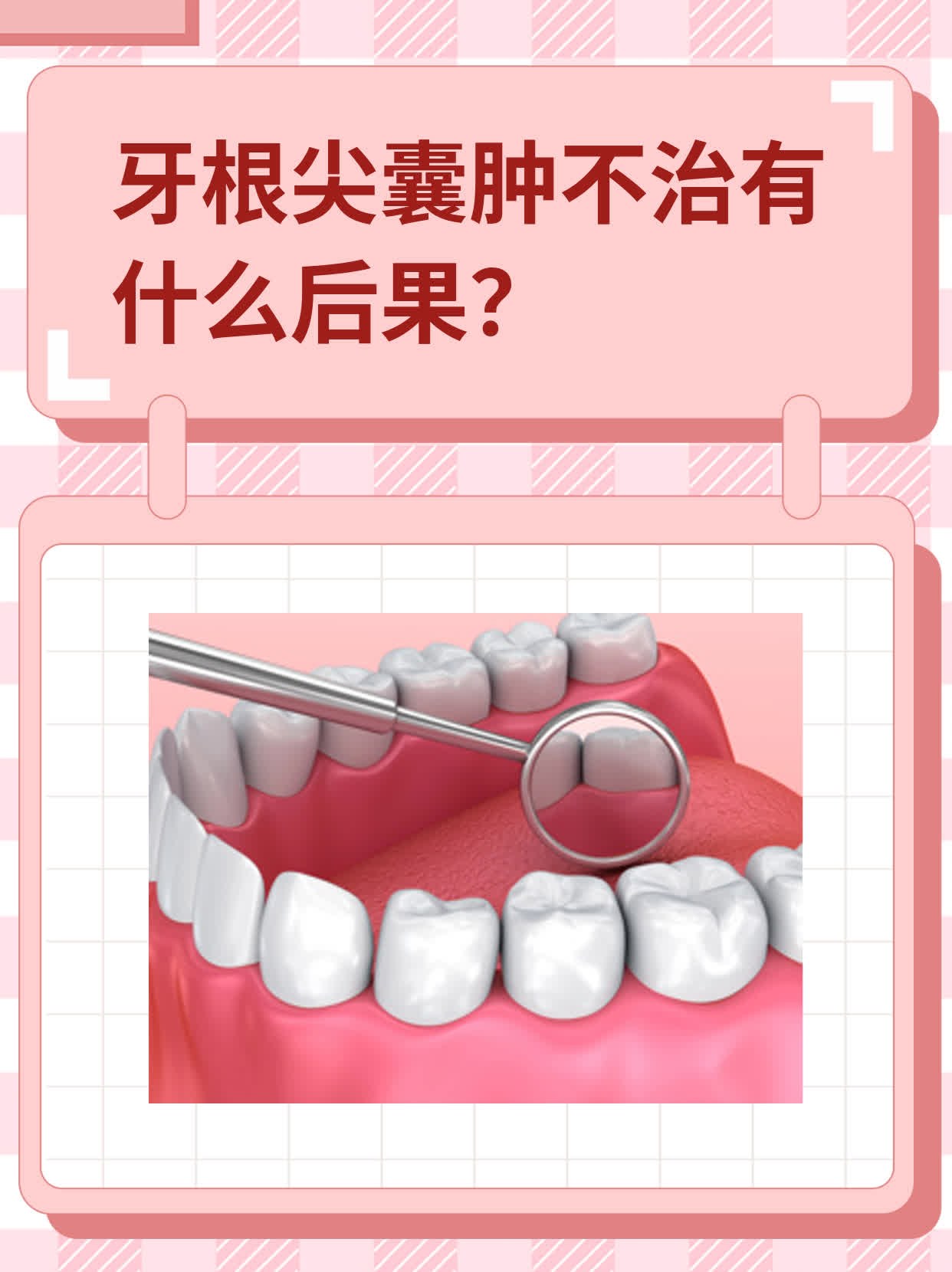 口腔牙根囊肿图片图片