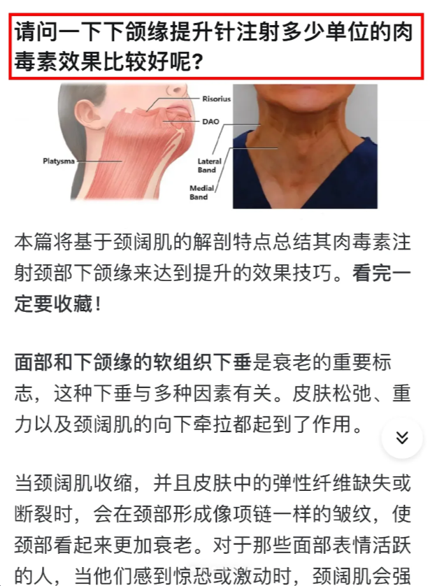 肉毒素放松颈阔肌图片