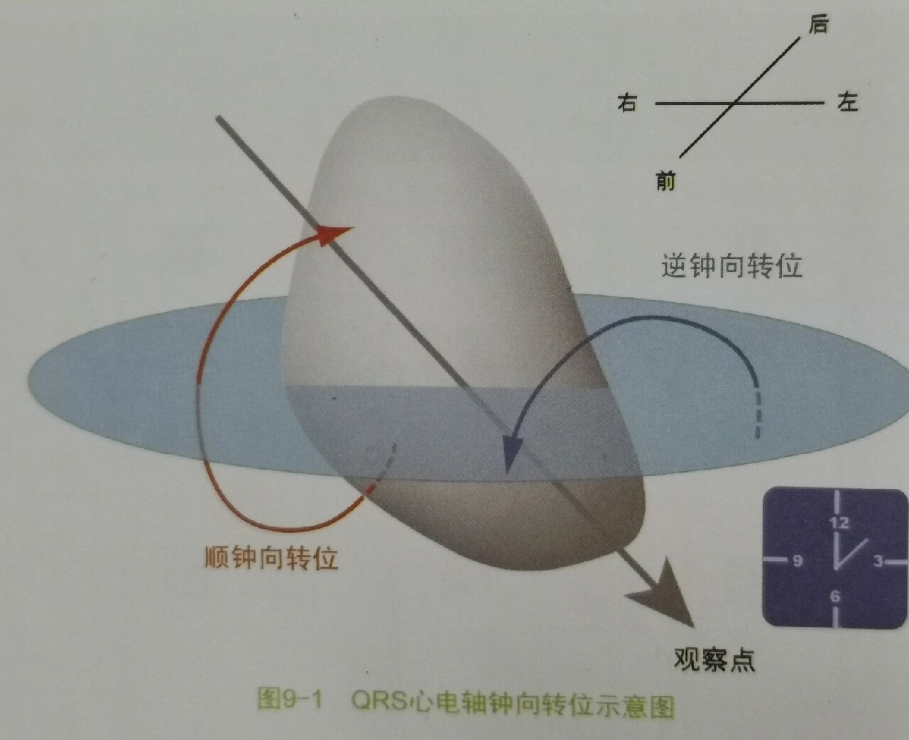 逆钟向转位心电图 全网资源