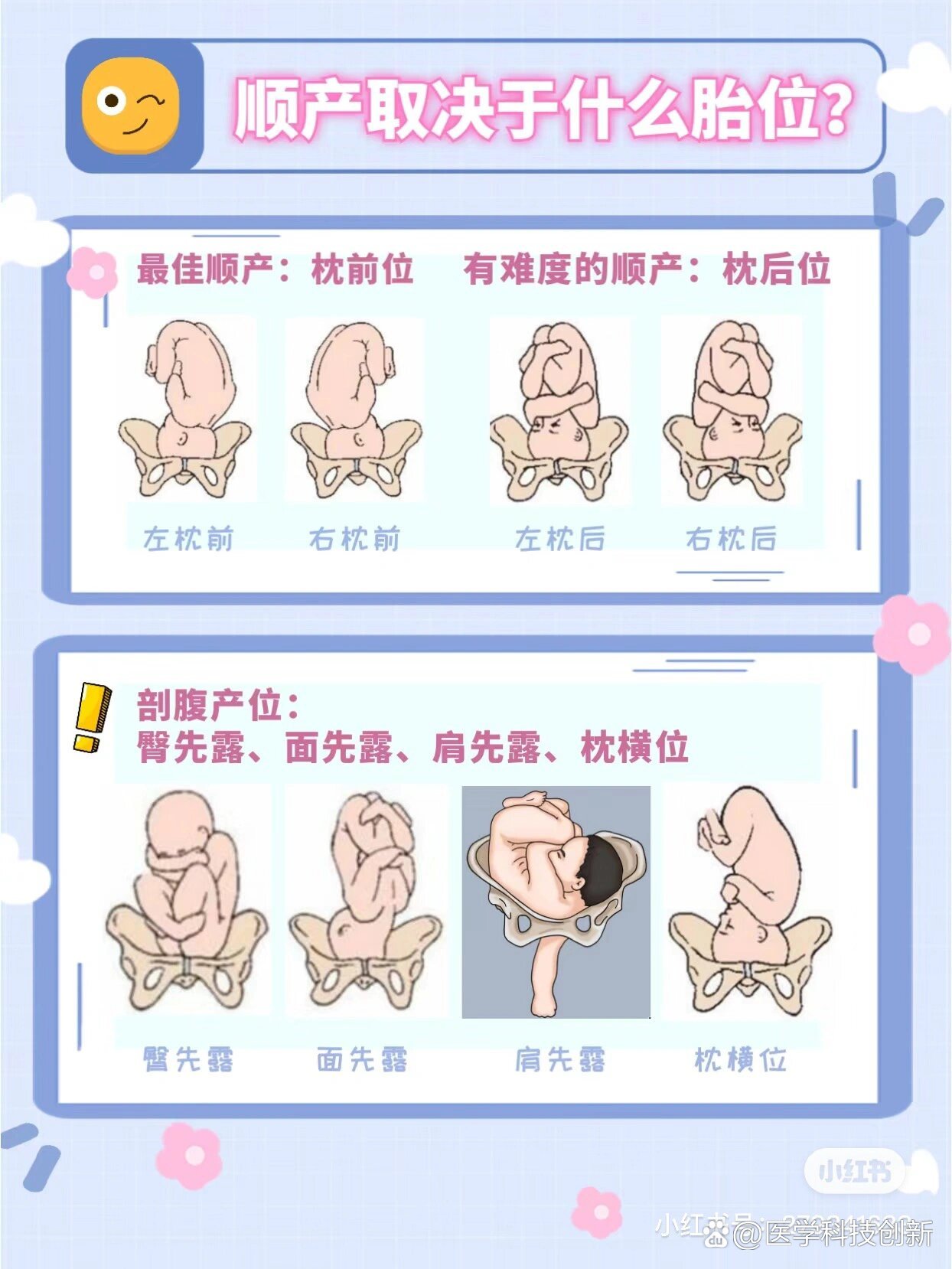  br>40 5今天拍b超变成了左枕横,上周还右枕前呢,老母亲的心真是操碎