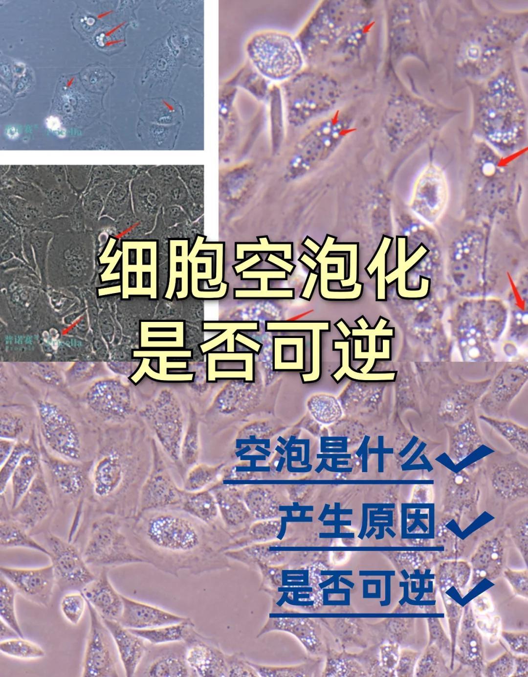 细胞空泡化：可逆还是不可逆？