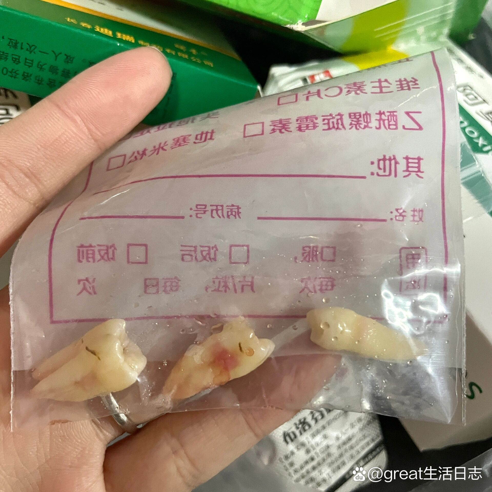 拔牙后吃什么因为要做正畸所有要拔牙,我觉得拔牙打麻药的时候