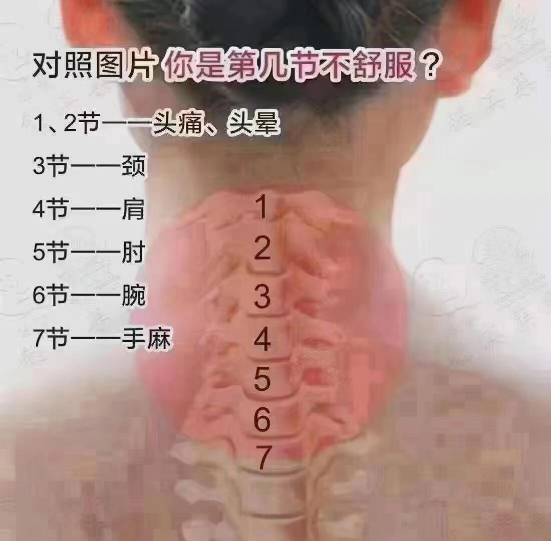 人体颈椎