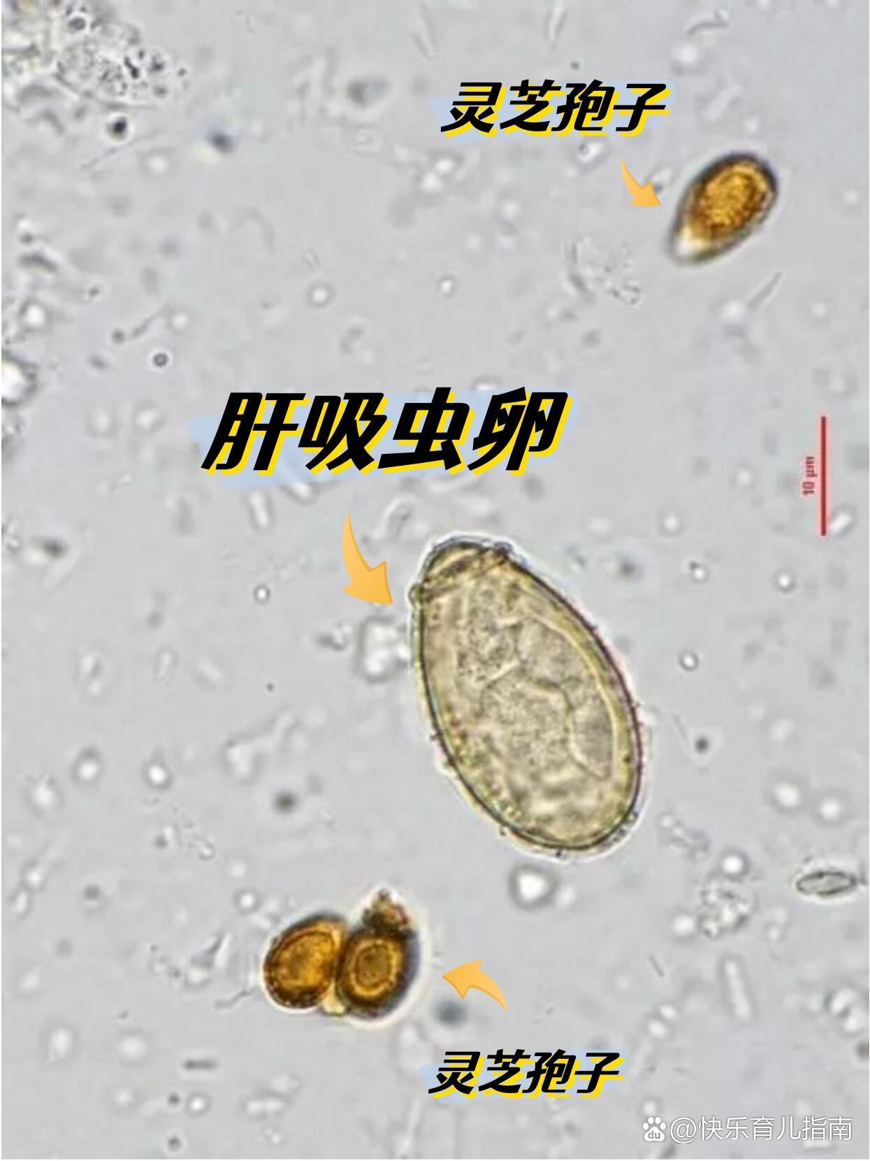 肝吸虫虫卵图片