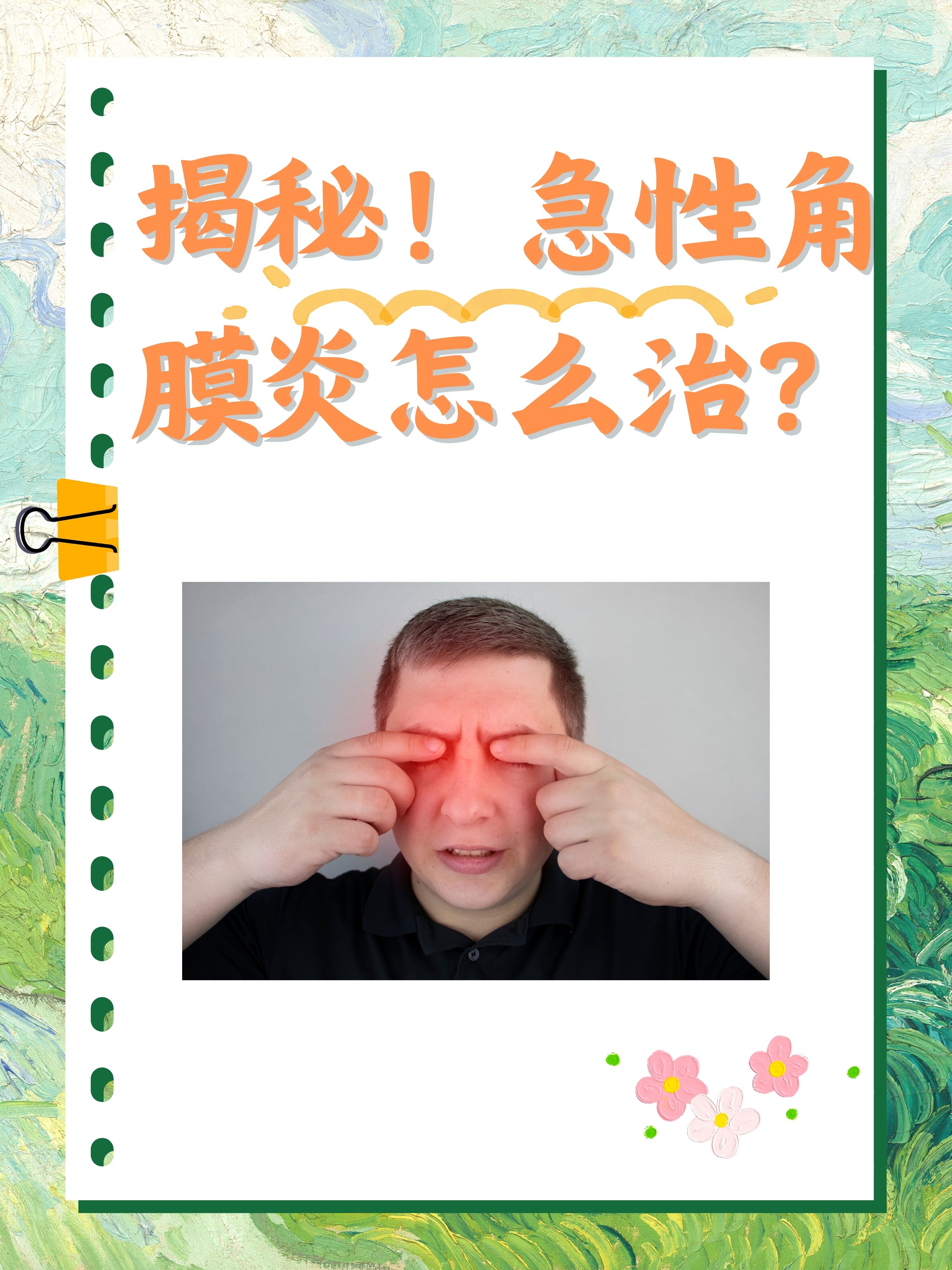 急性结膜炎怎么治疗最快?