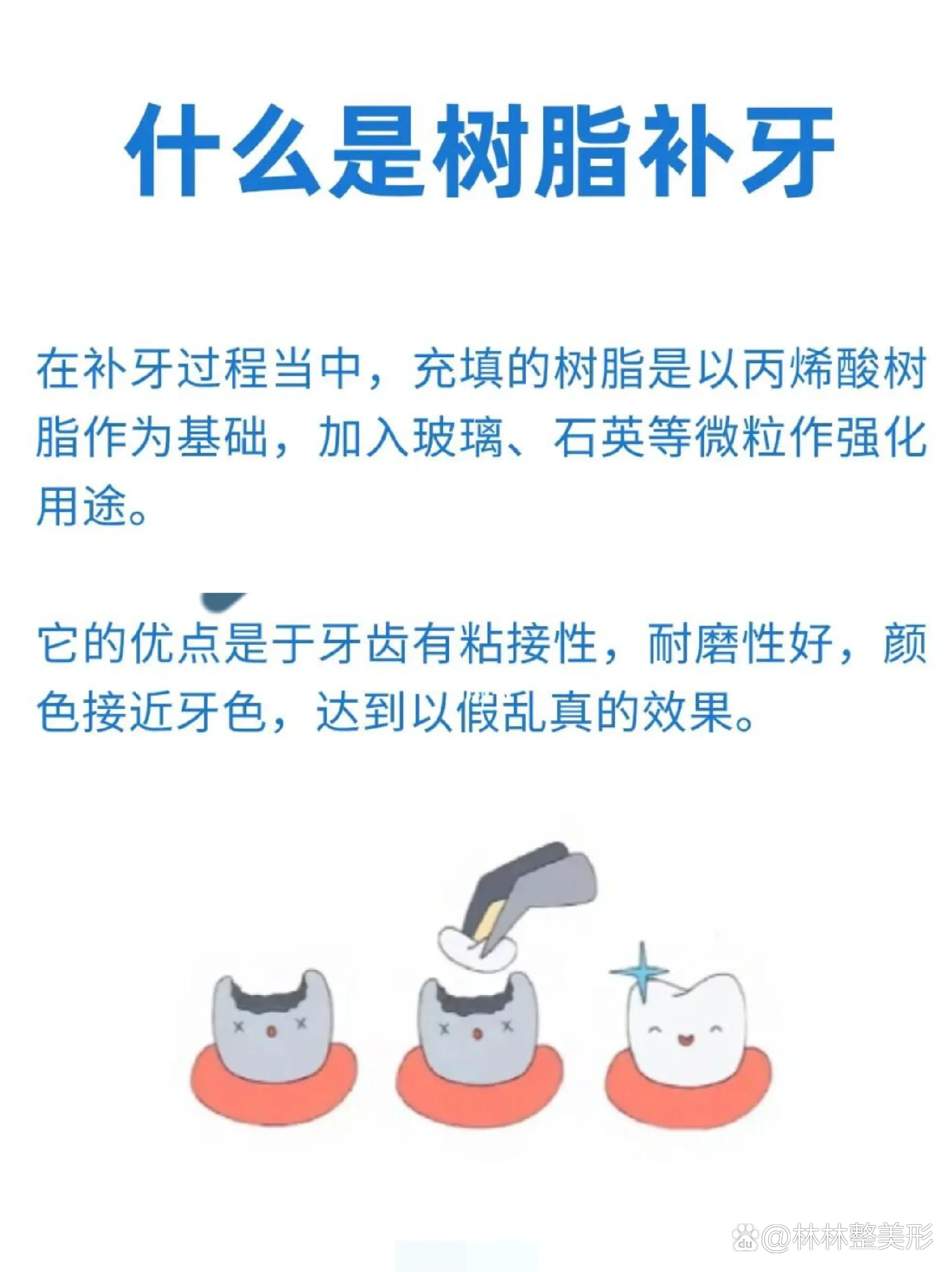  p>什么是树脂补牙 br>什么是树脂补牙 br>在补牙过程当中,充填的树脂
