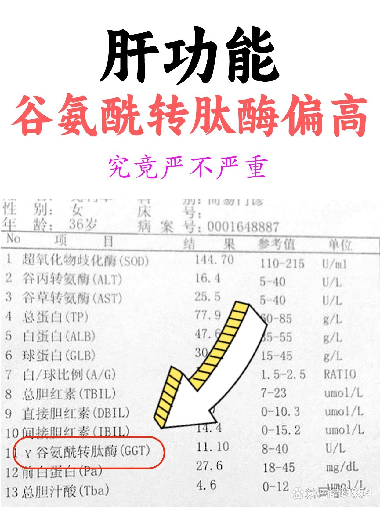 谷氨酰转肽酶偏高,到底严不严重?