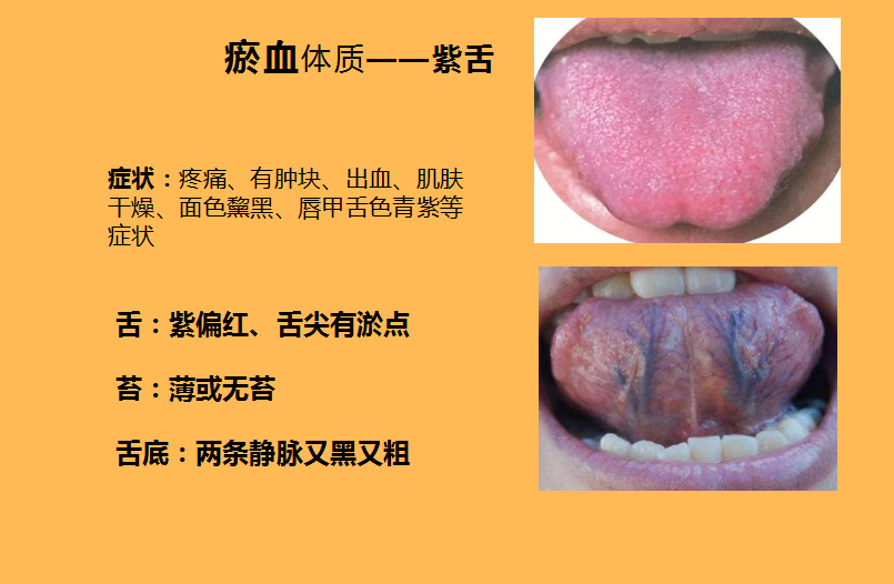 舌象反映不同的问题,分析五种 不同体质症状的舌象