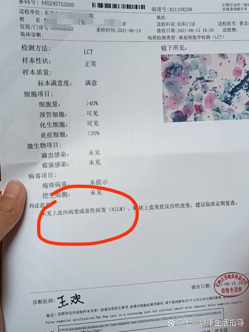 宫颈tct检查和hpv检查报告