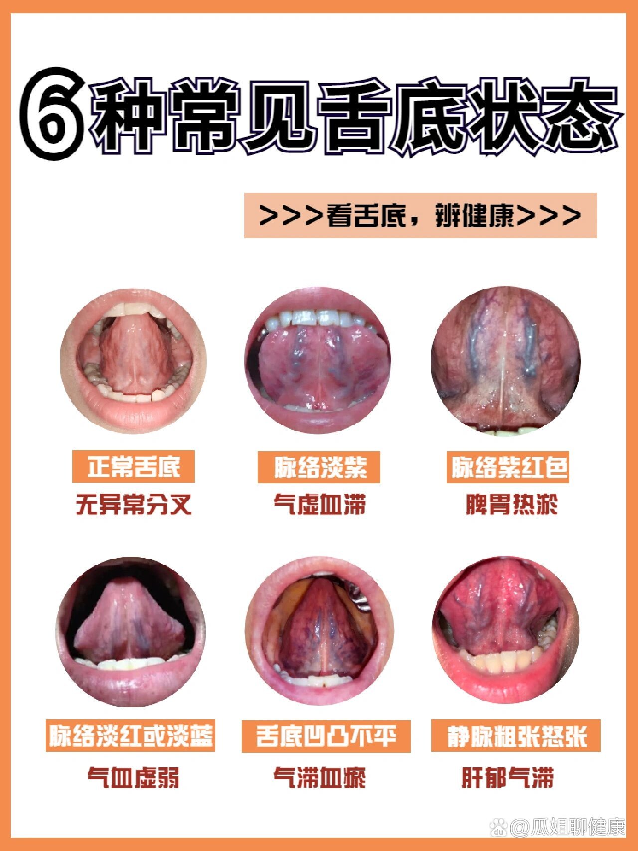 舌头的构造图片及名称图片