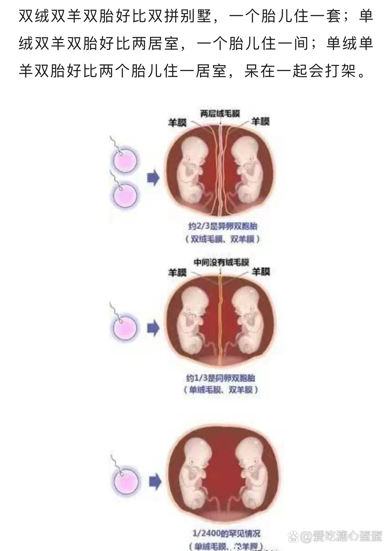 8.11双胎妊娠如何确定绒毛膜羊膜囊