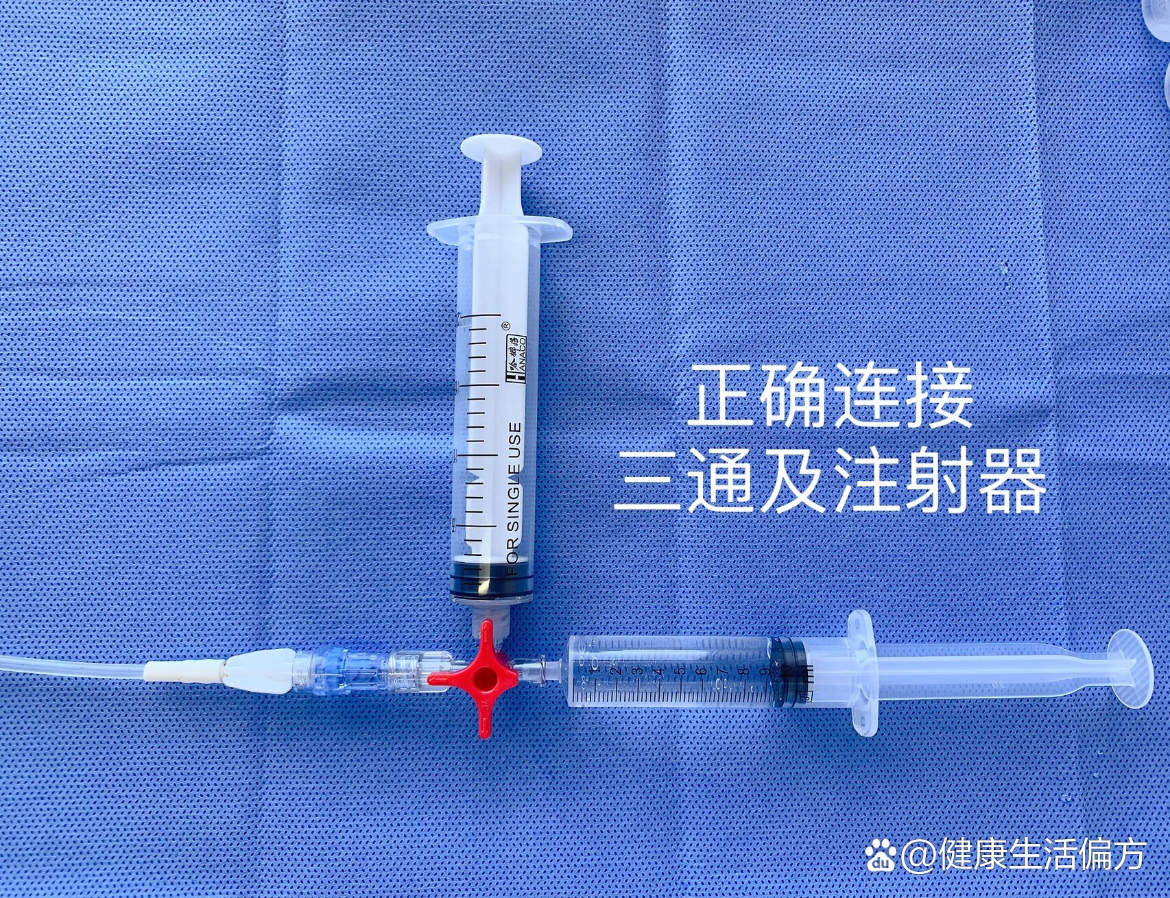 盐水或5000单位/ml尿激酶5-10ml(药物遵医嘱) br>	 br>94用法(全堵