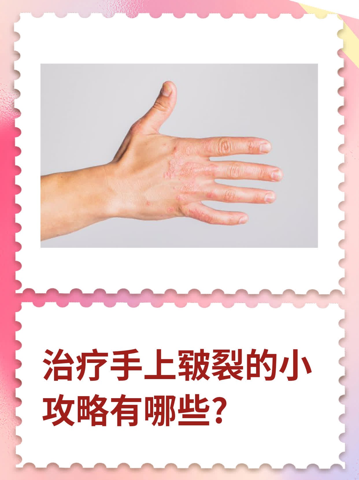 帮他治疗手部游戏攻略