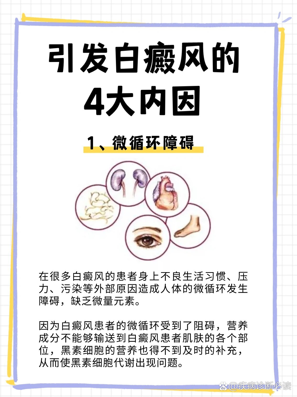 为什么会得白癜风