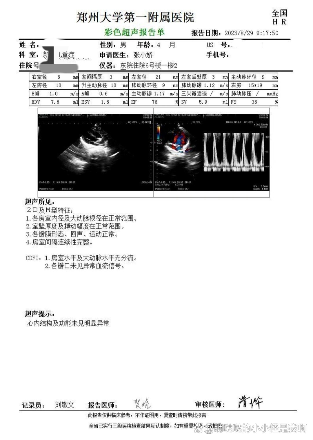 新生儿房间隔缺损图片