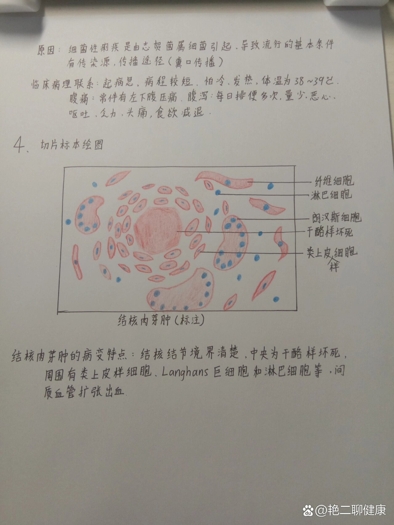 结核性肉芽肿绘图图片