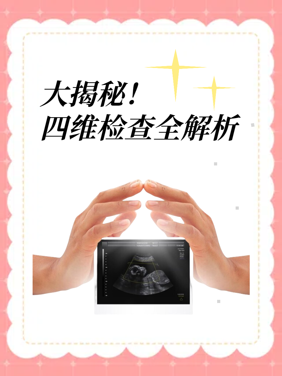 大揭秘!四维检查全解析