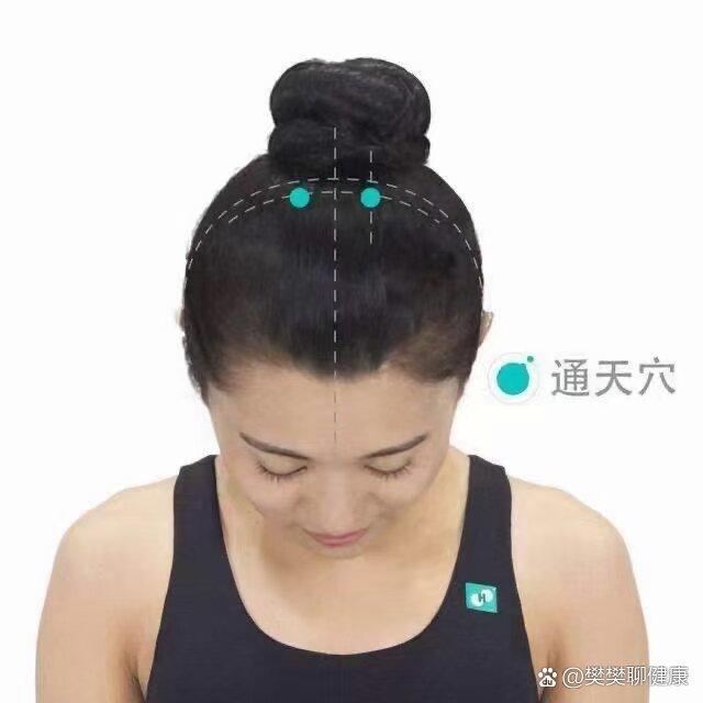 通天穴位置:在人的前发际向上4寸,同时距离人的前正中线旁开1.5寸.