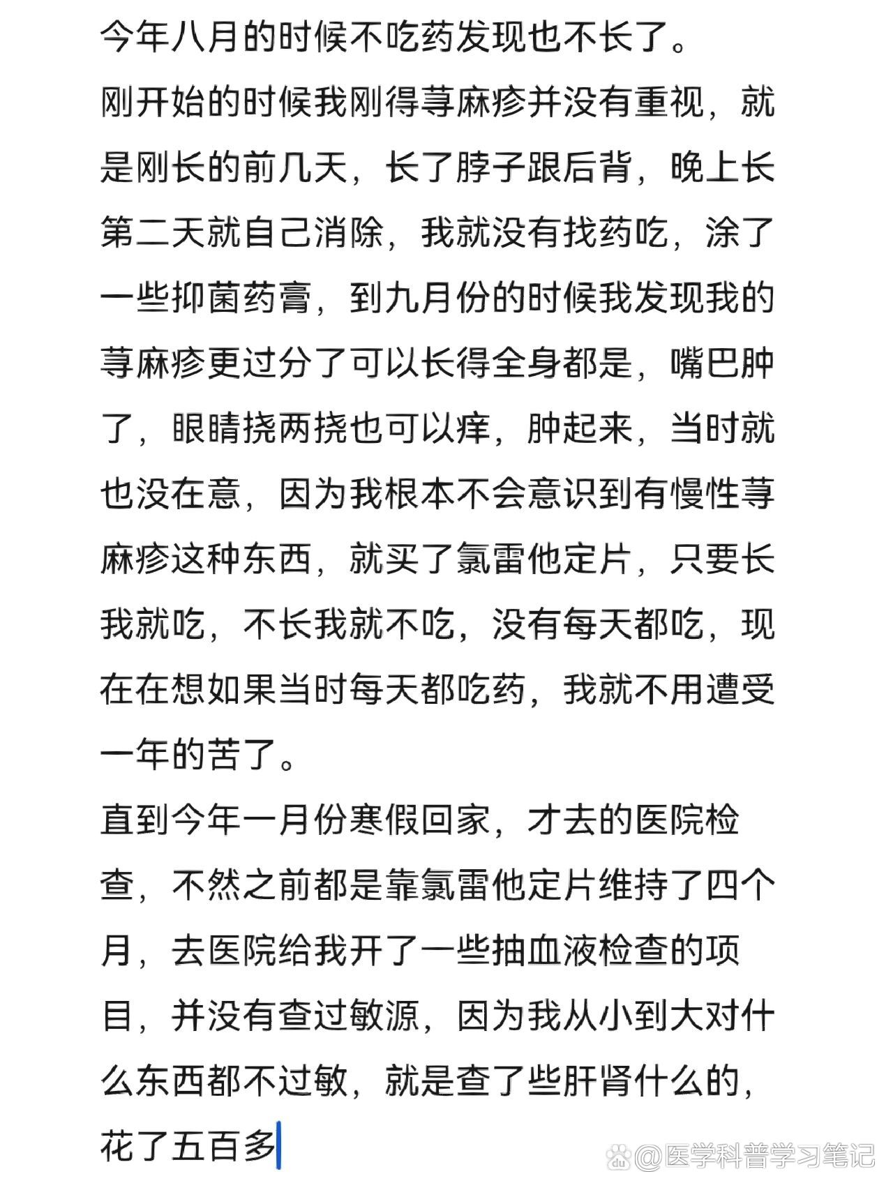 治好荨麻疹经验
