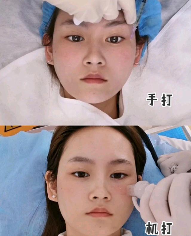 水光针过程是怎样的,水光针术后应注意的问题是什么?