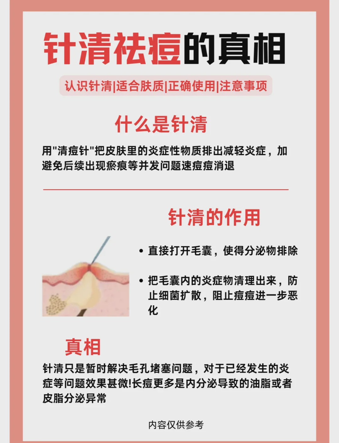 针清祛痘：你真的适合吗？