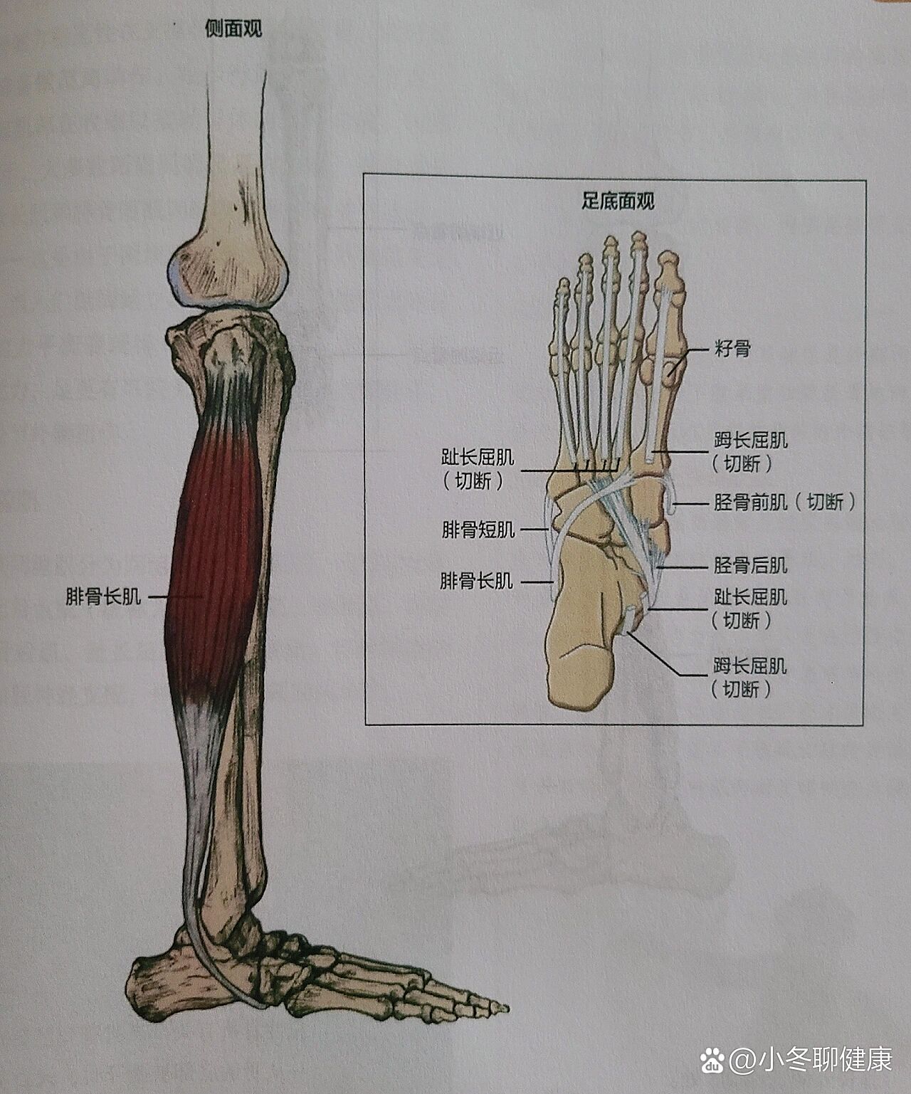 第四腓骨肌图片