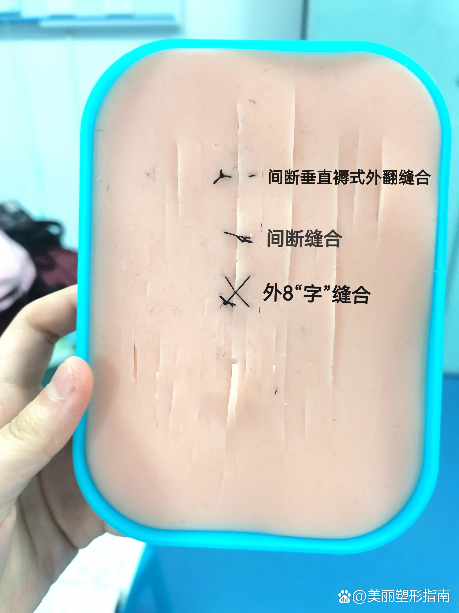 外科切口缝合