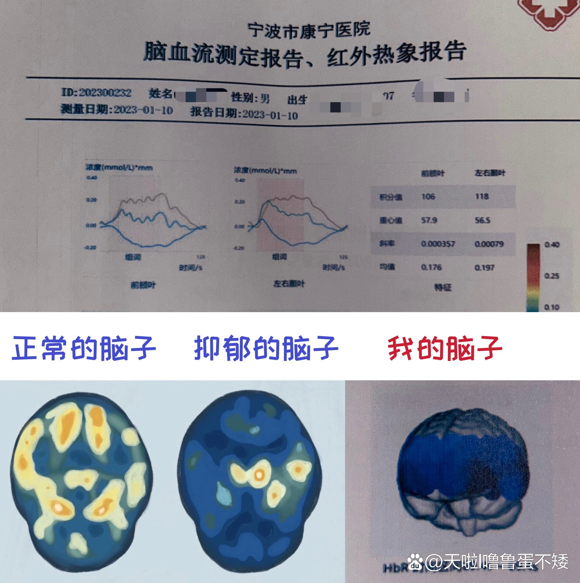 br>想要知道之前我图片里的脑部检查,不是什么脑部ct br>是这个脑血流