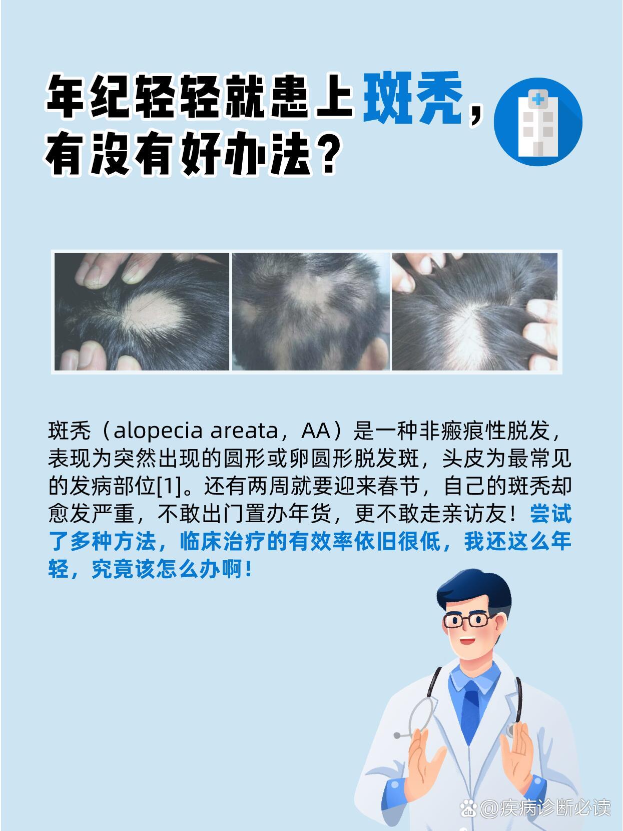急!年纪轻轻就患上斑秃,有没有好办法?