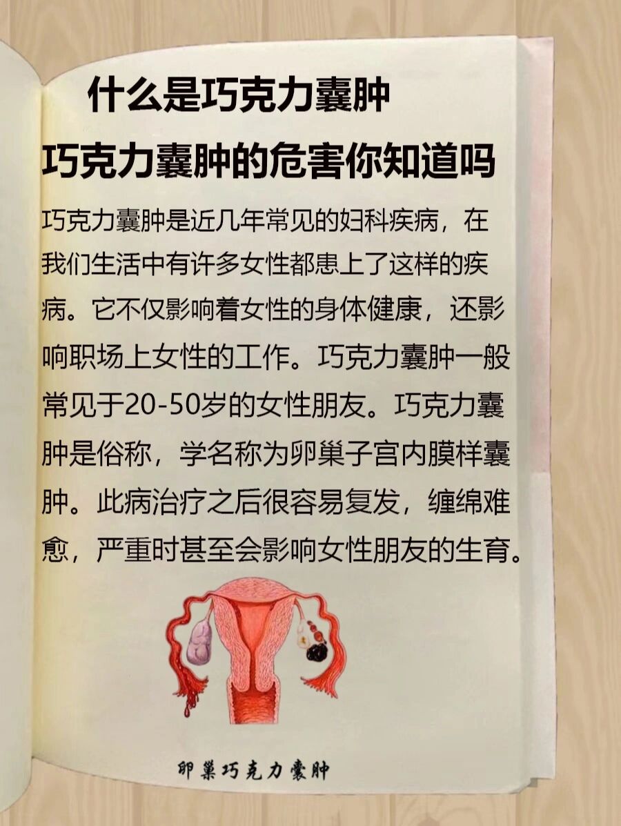 囊肿有什么危害图片