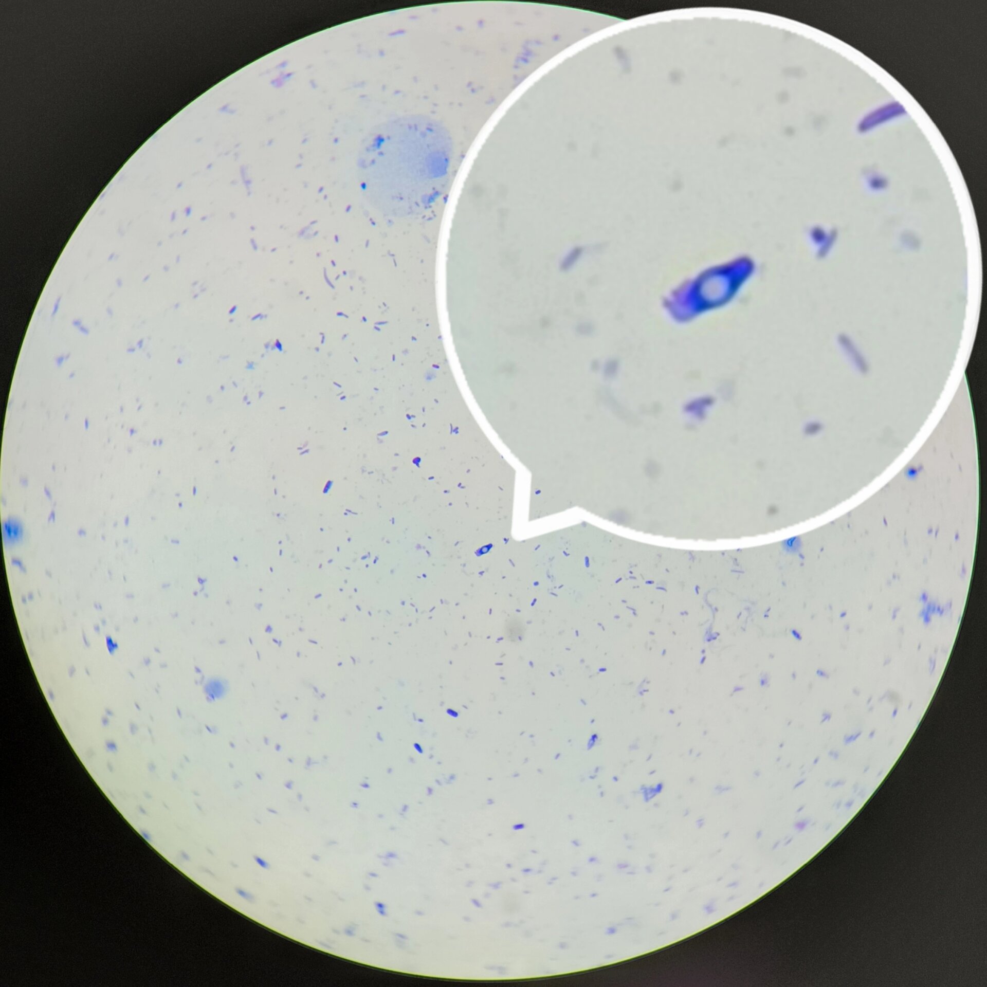 镜检〗芽孢杆菌产芽孢的位置与形态