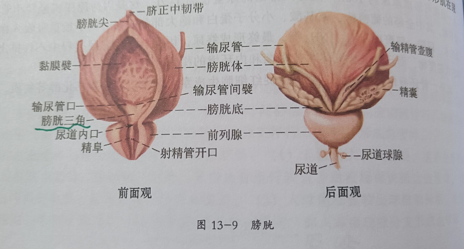 膀胱三角区解剖图图片