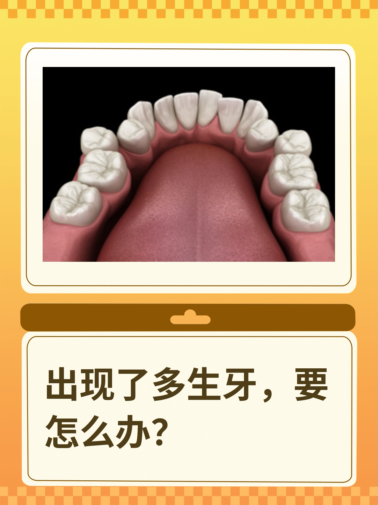 出现了多生牙,要怎么办