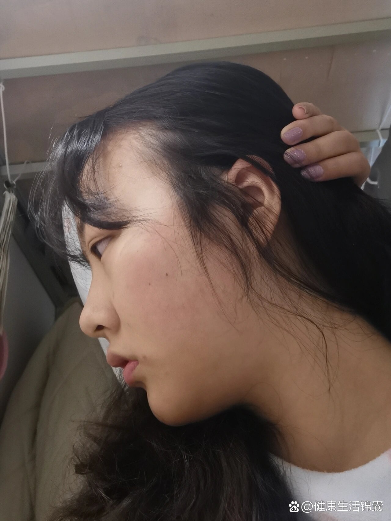 瘦十斤后的侧脸变化