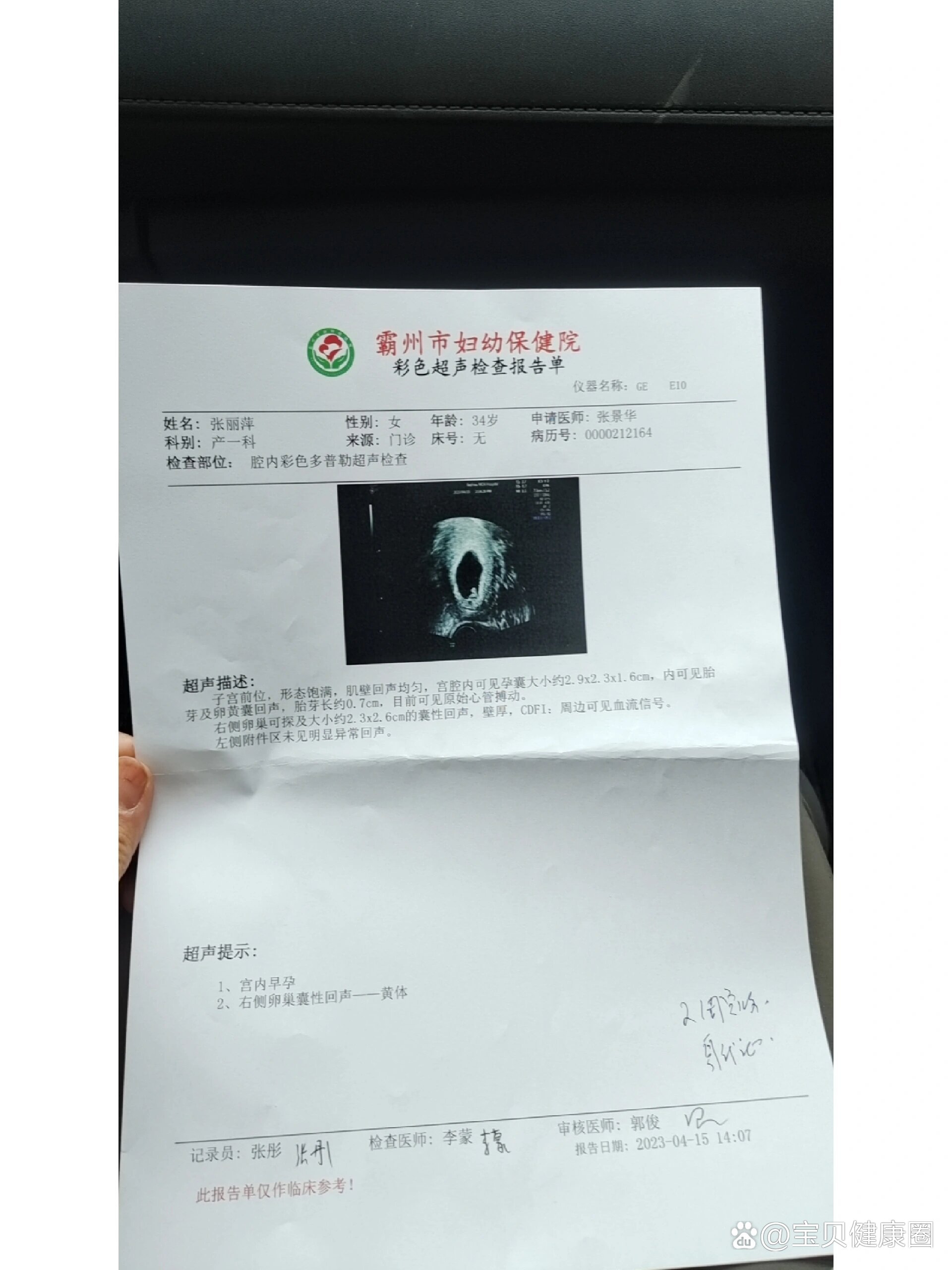 移植后30天可见胎芽胎心