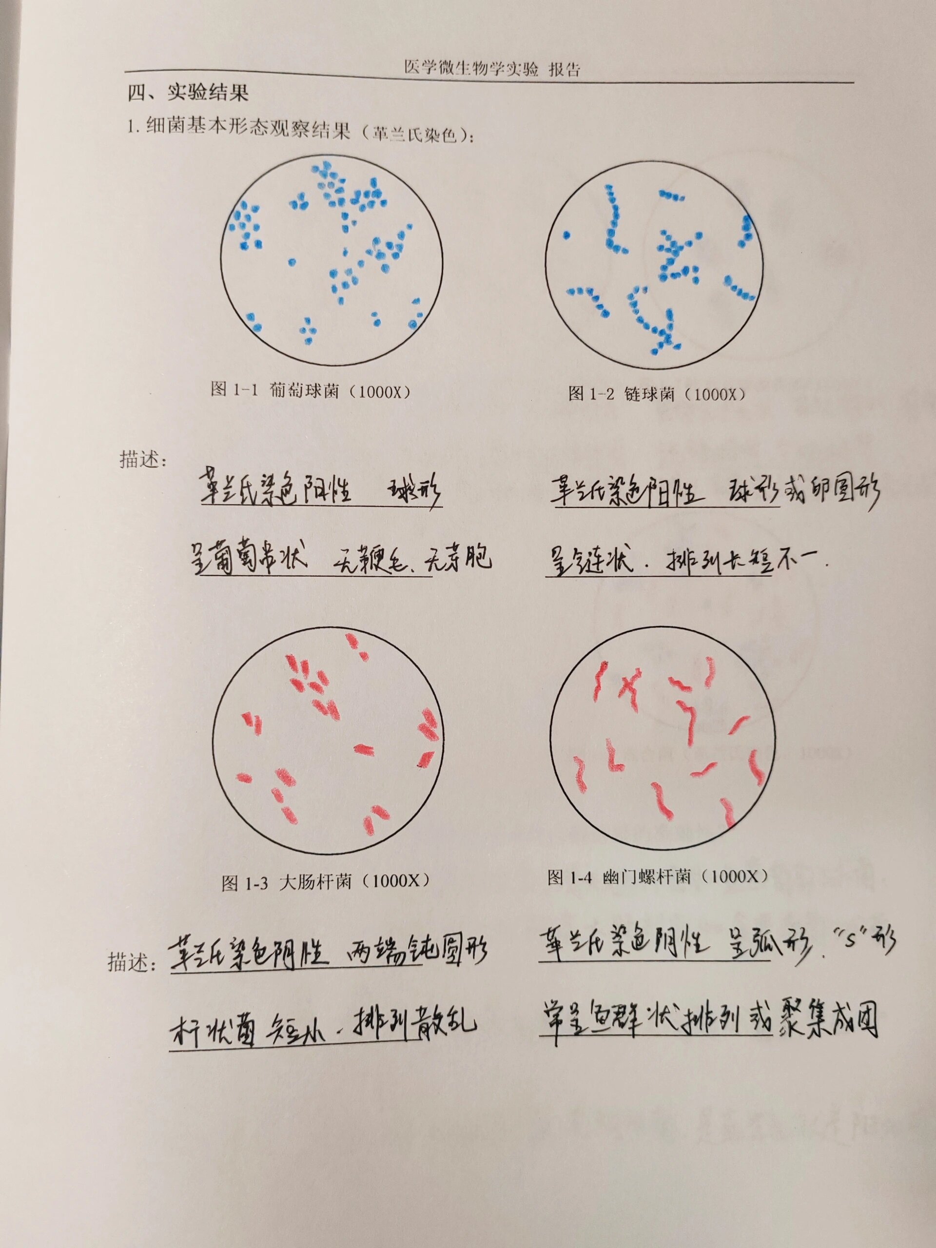 产气荚膜杆菌手绘图图片