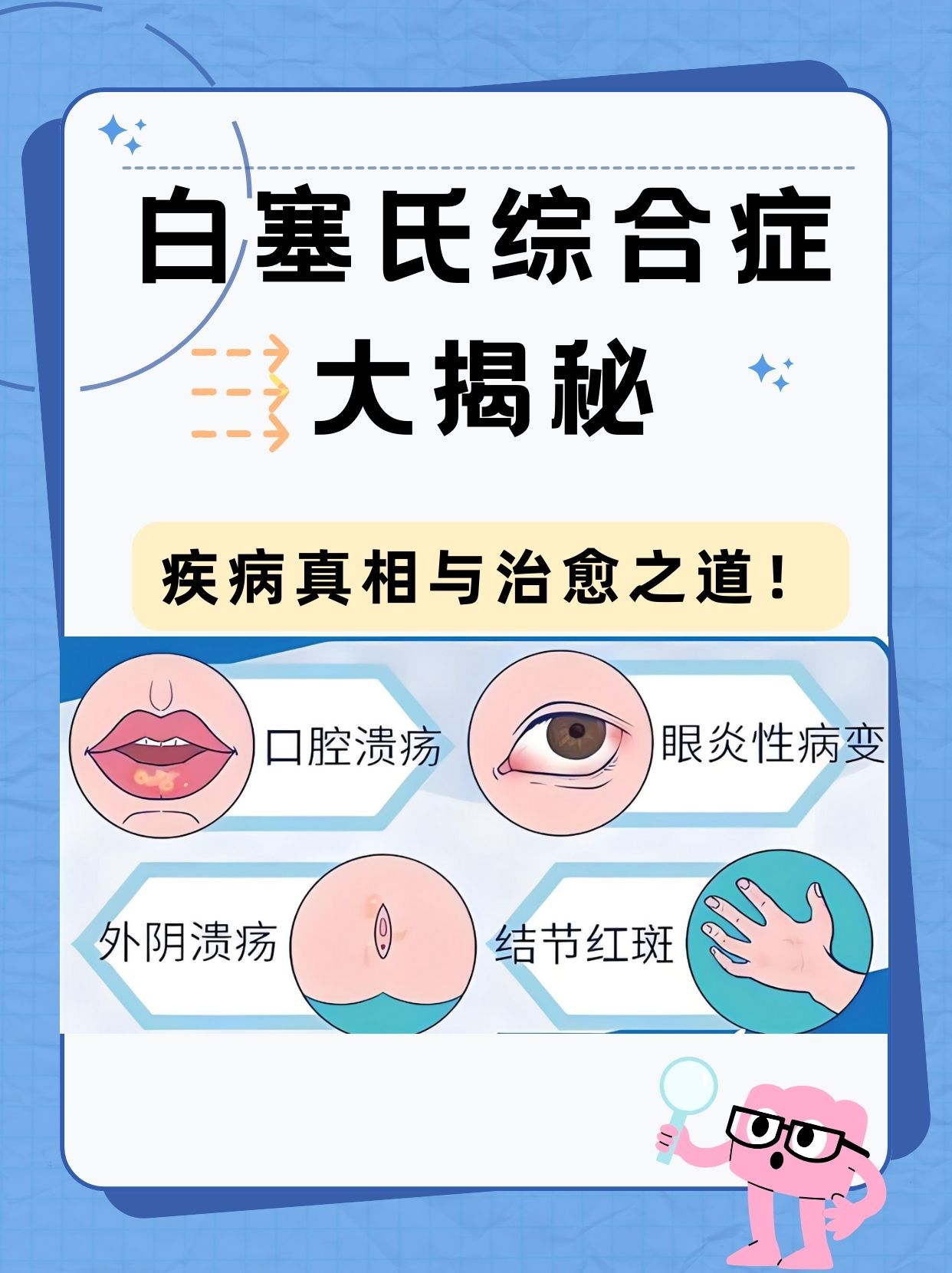 白塞氏综合症大揭秘:疾病真相与治愈之道!