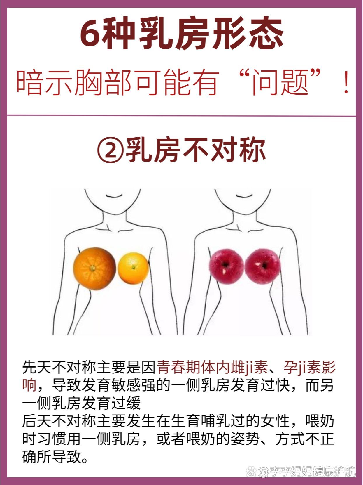 乳房的样子形态图片